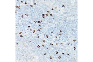 Immunohistochemistry of paraffin-embedded human tonsil using CD8A Rabbit mAb (ABIN1512846, ABIN3021030, ABIN3021031 and ABIN7101333) at dilution of 1:100 (40x lens). (CD8 alpha antibody)