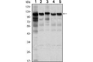 .Western blot analysis using HK1 mouse mAb against Jurkat (1), Hela (2), HepG2 (3), MCF-7 (4) and PC-12 (5) cell lysate. (Hexokinase 1 antibody)