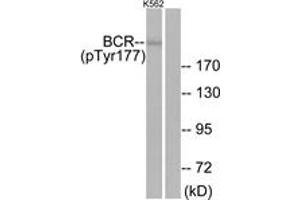 Western Blotting (WB) image for anti-Breakpoint Cluster Region (BCR) (pTyr177) antibody (ABIN2888372) (BCR antibody  (pTyr177))