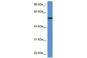 Phosphoglucomutase 5 antibody  (N-Term)