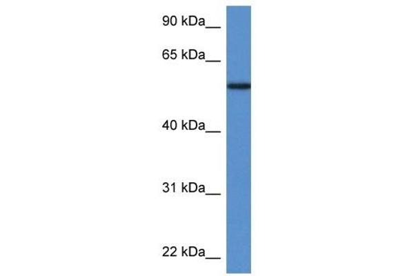 Phosphoglucomutase 5 antibody  (N-Term)