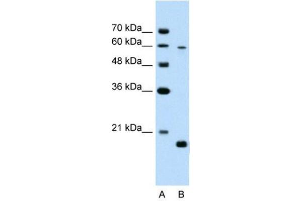 SLC38A4 antibody  (Middle Region)