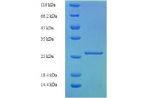 KIR2DS1 Protein (AA 22-245) (His tag)