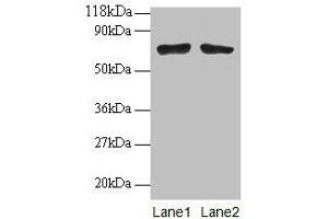 Western blot All lanes: BMI1 antibodyt 2 μg/mL Lane 1: EC109 whole cell lysate Lane 2: 293T whole cell lysate Secondary Goat polyclonal to rabbit IgG at 1/15000 dilution Predicted band size: 37 kDa Observed band size: 70 kDa (BMI1 antibody  (AA 1-247))