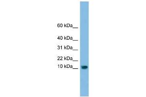 WB Suggested Anti-C13orf30 Antibody Titration: 0. (C13orf30 antibody  (N-Term))