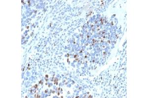 Immunohistochemistry (IHC) image for anti-Cyclin-Dependent Kinase Inhibitor 1A (p21, Cip1) (CDKN1A) (AA 1-100) antibody (ABIN7504137)