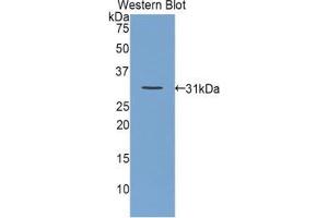 Western blot analysis of the recombinant protein. (OTC antibody  (AA 107-350))