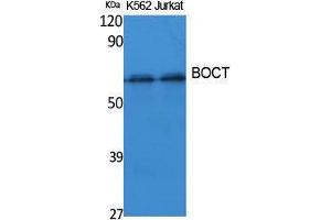 Western Blotting (WB) image for anti-Solute Carrier Family 22 (Organic Cation Transporter), Member 17 (SLC22A17) (Internal Region) antibody (ABIN3178094) (SLC22A17 antibody  (Internal Region))