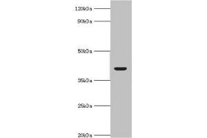 Western blot All lanes: Alcohol dehydrogenase 4 antibody at 2 μg/mL + Mouse liver tissue Secondary Goat polyclonal to rabbit IgG at 1/10000 dilution Predicted band size: 41, 43 kDa Observed band size: 41 kDa (ADH4 antibody  (AA 1-380))