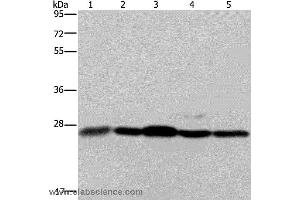 Western blot analysis of Human hepatocellular carcinoma tissue, Hela and Jurkat cell, 293T cell and human breast infiltrative duct tissue, using HMGB1 Polyclonal Antibody at dilution of 1:200 (HMGB1 antibody)