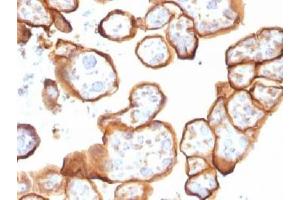 IHC testing of FFPE human placenta with Thrombomodulin antibody (clone THBD/1591). (Thrombomodulin antibody  (AA 69-194))