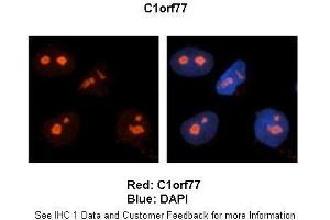 Sample Type: Human brain stem cells (NT2)  Primary Antibody Dilution: 1:500Secondary Antibody: Goat anti-rabbit Alexa Fluor 594 Secondary Antibody Dilution: 1:0000Color/Signal Descriptions: Red: C1orf77 Blue: DAPI  Gene Name: C1orf77 Submitted by: Dr. (CHTOP antibody  (Middle Region))