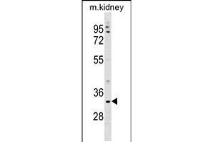 Western blot analysis in mouse kidney tissue lysates (35ug/lane). (TMEM178 antibody  (AA 128-156))