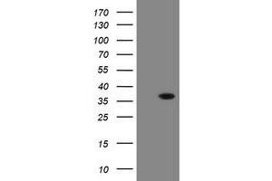 Image no. 2 for anti-Snail Family Zinc Finger 2 (SNAI2) antibody (ABIN1500981) (SLUG antibody)