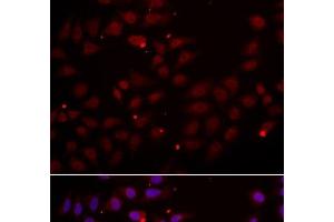 Immunofluorescence analysis of HeLa cells using CST2 Polyclonal Antibody (CST2 antibody)