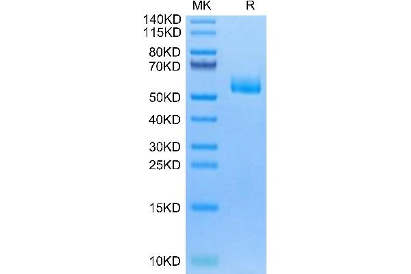 CPM Protein (AA 18-423) (His tag)