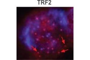 Image no. 1 for anti-Telomeric Repeat Binding Factor 2 (TERF2) antibody (ABIN208252) (TRF2 antibody)