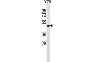 ZFYVE19 Antibody (C-term) western blot analysis in Y79 cell line lysates (35 µg/lane). (ZFYVE19 antibody  (C-Term))