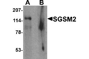 Western blot analysis of SGSM2 in human cerebellum tissue lysate with SGSM2 antibody at 1 µg/mL in (A) the absence and (B) the presence of blocking peptide (SGSM2 antibody  (Middle Region))
