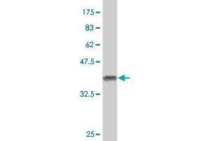 Western Blot detection against Immunogen (37. (Epsin 2 antibody  (AA 1-101))