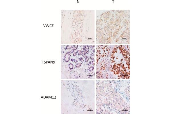 ADAM12 antibody  (AA 589-738)