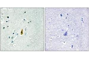 Immunohistochemistry analysis of paraffin-embedded human brain, using p53 (Phospho-Thr81) Antibody. (p53 antibody  (pThr81))