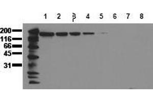 Western Blotting (WB) image for anti-Epidermal Growth Factor Receptor (EGFR) (AA 1140-1160) antibody (ABIN126774) (EGFR antibody  (AA 1140-1160))