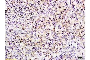 Pkc beta 1 antibody  (pSer642)