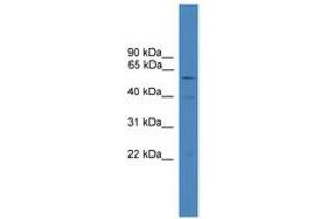 Image no. 1 for anti-SHANK-Associated RH Domain Interacting Protein (SHARPIN) (AA 301-350) antibody (ABIN6745299) (SHARPIN antibody  (AA 301-350))