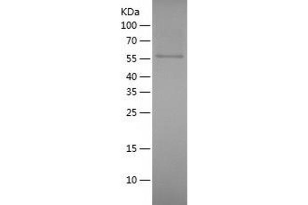 DPYSL5 Protein (AA 1-564) (His tag)