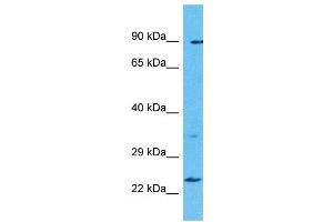 Host: Rabbit Target Name: TBC1D28 Sample Type: Uterus Tumor lysates Antibody Dilution: 1. (TBC1D28 antibody  (Middle Region))