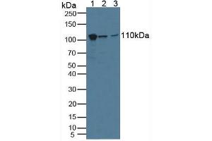 Western blot analysis of (1) Human A549 Cells, (2) Human HeLa cells and (3) Human Lung Tissue. (MVP antibody  (AA 2-272))