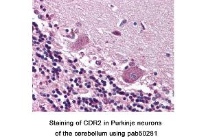 Image no. 1 for anti-Cerebellar Degeneration-Related Protein 2, 62kDa (CDR2) (C-Term) antibody (ABIN363590) (CDR2 antibody  (C-Term))