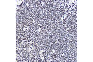 Immunohistochemistry of paraffin-embedded mouse embryos using SOX1 Rabbit pAb (ABIN3017344, ABIN3017345, ABIN3017346 and ABIN1682856) at dilution of 1:25 (40x lens). (SOX1 antibody)