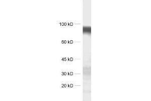 dilution: 1 : 1000, sample: synaptic membrane fraction of rat brain (LP1) (LRRTM4 antibody)