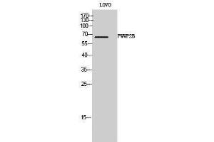 Western Blotting (WB) image for anti-PWWP Domain Containing 2B (PWWP2B) (Internal Region) antibody (ABIN3186604) (PWWP2B antibody  (Internal Region))