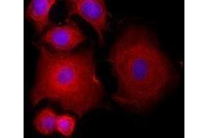 Immunofluorescence (IF) image for anti-Keratin 19 (KRT19) antibody (Alexa Fluor 594) (ABIN2656841) (Cytokeratin 19 antibody  (Alexa Fluor 594))
