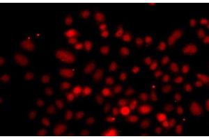 Immunofluorescence analysis of A549 cells using RRAGC Polyclonal Antibody (GTR2 antibody)