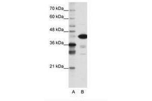 Image no. 1 for anti-TAR DNA Binding Protein (TARDBP) (N-Term) antibody (ABIN202468) (TARDBP antibody  (N-Term))