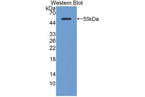 Western blot analysis of the recombinant protein. (KRT14 antibody  (AA 1-484))