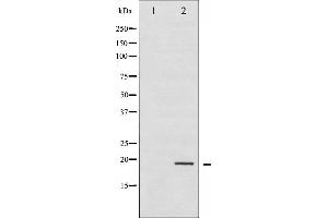 Western blot analysis of Stathmin 1 phosphorylation expression in PMA treated Jurkat whole cell lysates,The lane on the left is treated with the antigen-specific peptide. (Stathmin 1 antibody  (pSer25))