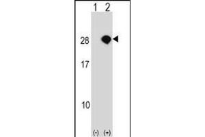 Western blot analysis of AKIRIN2 (arrow) using rabbit polyclonal AKIRIN2 Antibody (C-term) (ABIN1536792 and ABIN2848806). (AKIRIN2 antibody  (C-Term))