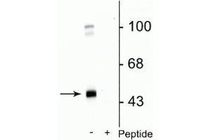 Western blot of rat cortical lysate showing specific immunolabeling of the ~45 kDa GABAA γ2 protein phosphorylated at Ser327 in the first lane (-). (GABRG2 antibody  (pSer327))