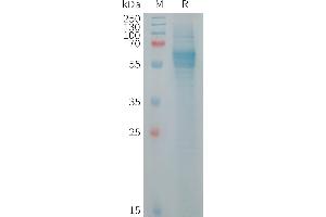 Human F Protein, His Tag on SDS-PAGE under reducing condition. (FCRL2 Protein (AA 20-398) (His tag))