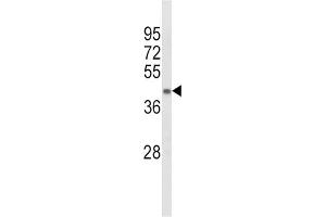 Western Blotting (WB) image for anti-Acyl-CoA Dehydrogenase, Long Chain (ACADL) antibody (ABIN3003793) (ACADL antibody)