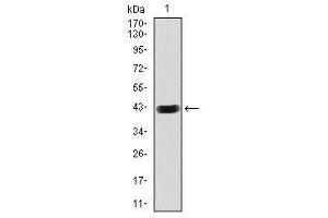 Image no. 1 for anti-Hexosaminidase A (HEXA) antibody (ABIN1498642) (Hexosaminidase A antibody)