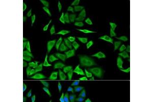 Immunofluorescence analysis of MCF-7 cells using DBI Polyclonal Antibody (Diazepam Binding Inhibitor antibody)