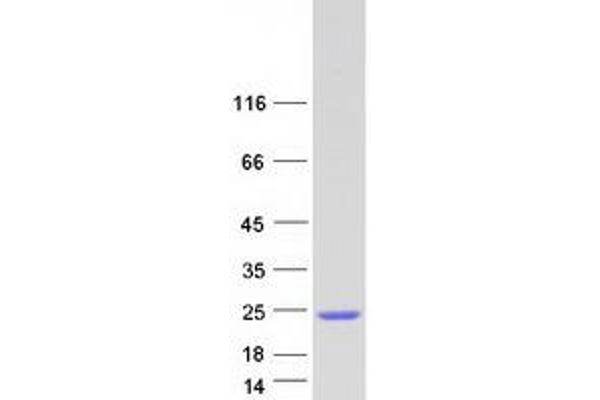 DPY30 Protein (Myc-DYKDDDDK Tag)