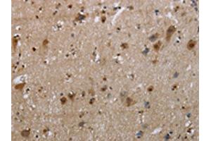 The image on the left is immunohistochemistry of paraffin-embedded Human brain tissue using ABIN7129329(EGFL8 Antibody) at dilution 1/30, on the right is treated with fusion protein. (EGFL8 antibody)