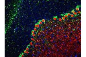 Immunostaining (ISt) image for anti-Calbindin (CALB1) antibody (ABIN6254097)